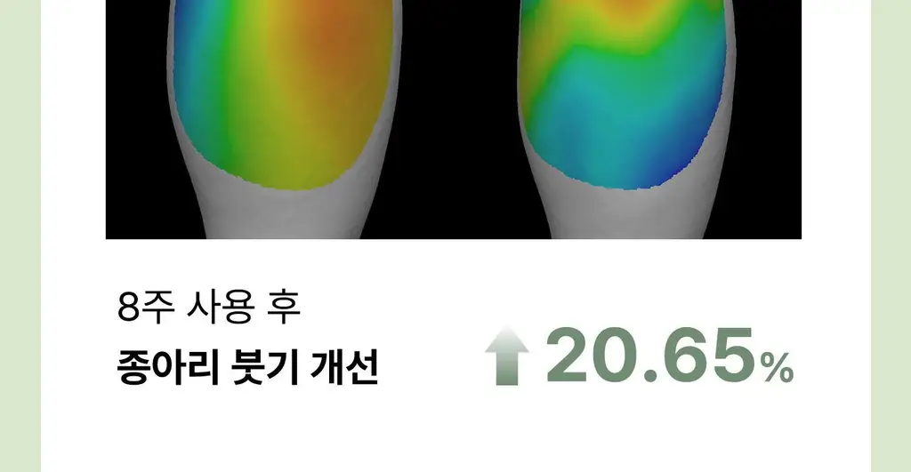 [탄력/목주름 개선] 힐그리즈 레티노이드 0.1% 퍼밍 바디 세럼 150ml 상세페이지 36